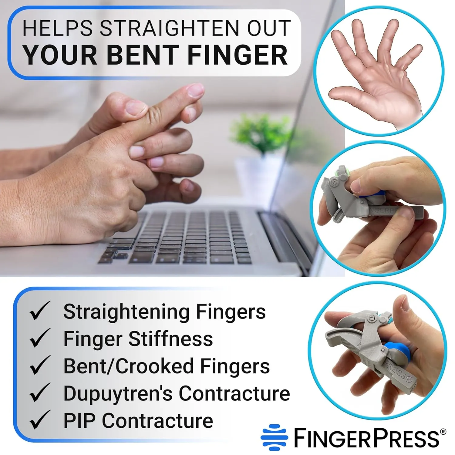 Finger Straightener | PIP Extension Orthosis/Splint For Bent Fingers, PIP Flexion Contractures | Adjustable Joint Stretcher Device | Made in USA | Blue/Large